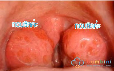 การนอนกรนในเด็ก ไม่ใช่เรื่องเล็กอีกต่อไป