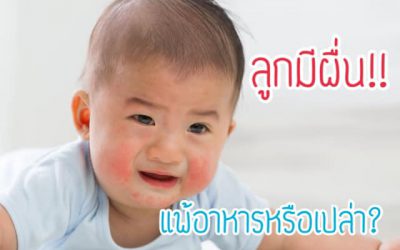 อาการ ผื่นขึ้น ของลูกเกิดจากอะไรได้บ้าง